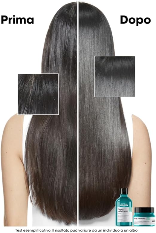 L'Oreal Professionnel- Scalp Advanced Shampoo per cute grassa